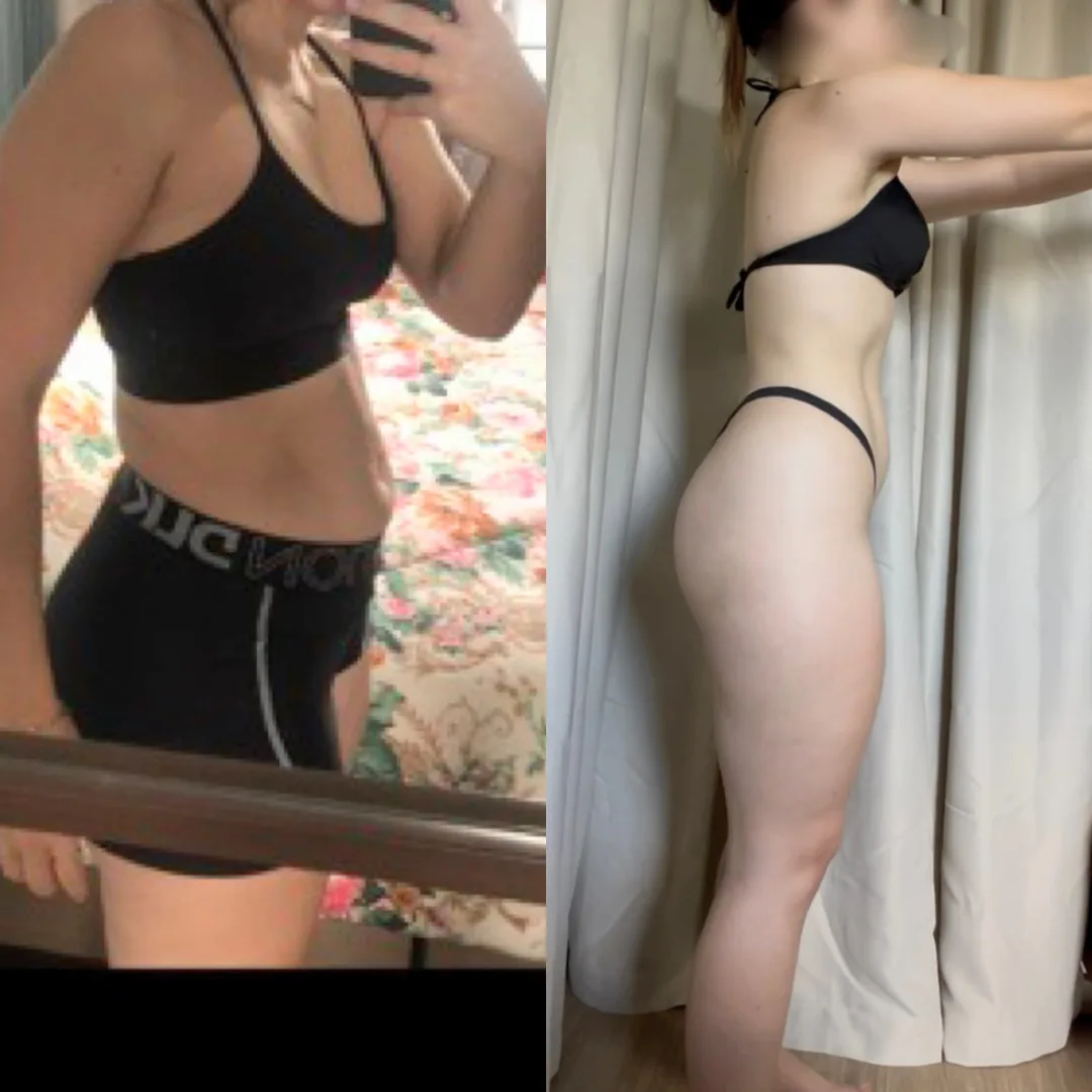 Resultado de aluna Verus — antes e depois